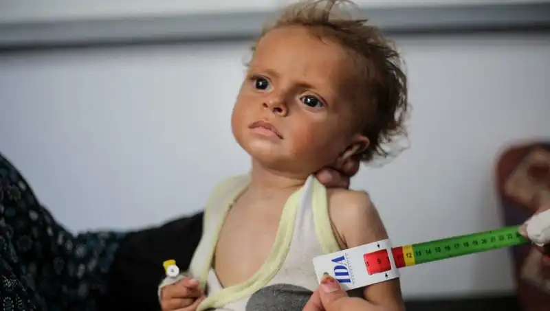 İngiltere, 300 Gazzeli Çocuğa Yeni Bir Yaşam Sunuyor