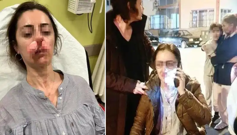 Eşinin Sevgilisi Sandığına Otomobil Kapısıyla Saldırdı: Olayın Ayrıntıları Şaşırtıyor