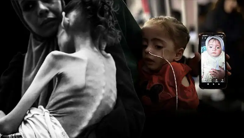 25 Kilodan 10 Kiloya Düşen Küçük Meryem'in Üzücü Hikayesi