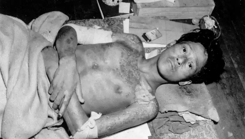 80 Yıl Sonra Nagasaki’den Gelen Korkutucu Mesaj: Nükleer Tehdit Yeniden Kapımızda!